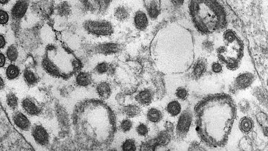 Marburg fever detected in Guinea
